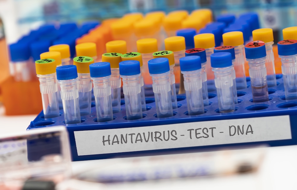 Hanta virus onderzoek